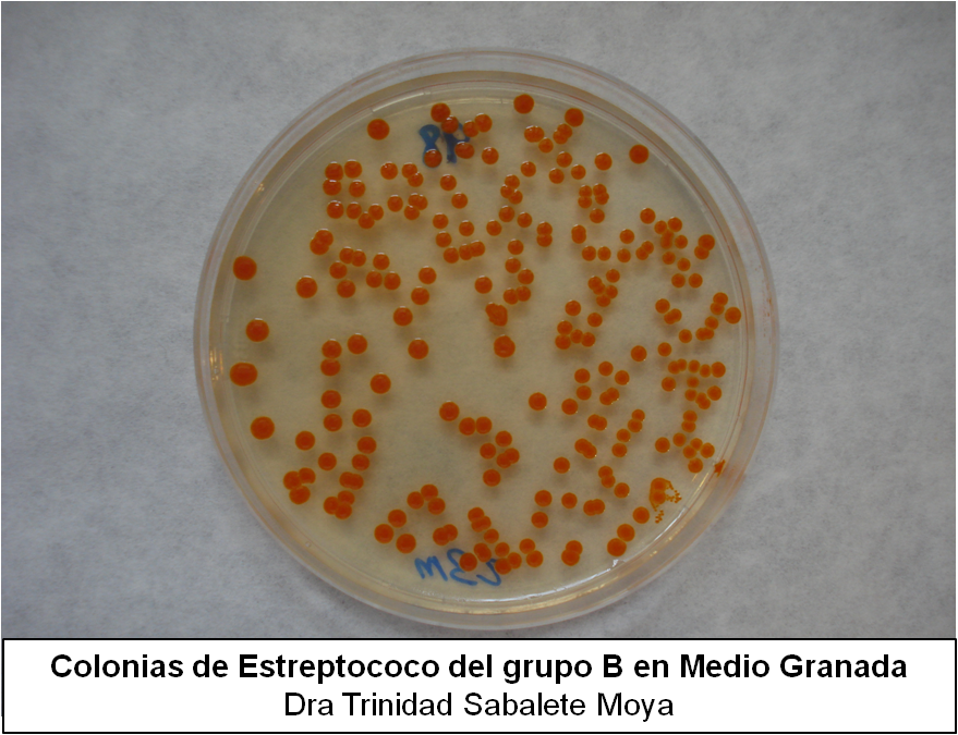 Vomitar Bilis Color Marron Mujer Embarazada Vomitar Bilis Color Marron Mujer Embarazada