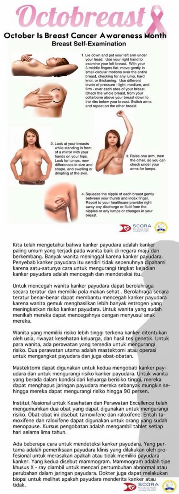 evista used prevent breast cancer