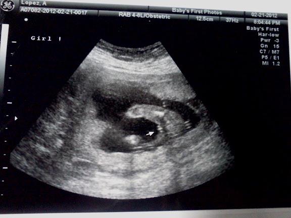 girl sonogram girl sonogram