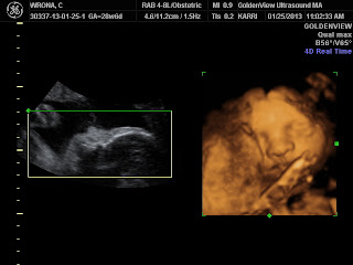 3D/4D Ultrasound at 29 weeks