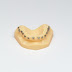 Como a impressão 3D vai mudar a vida do Dentista