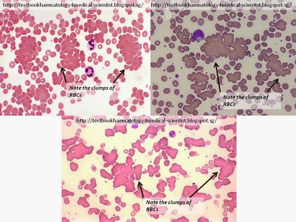 Agglutination.html | Autos Post
