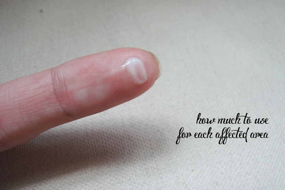 Review Epiduo Gel for Acne Curated Taste