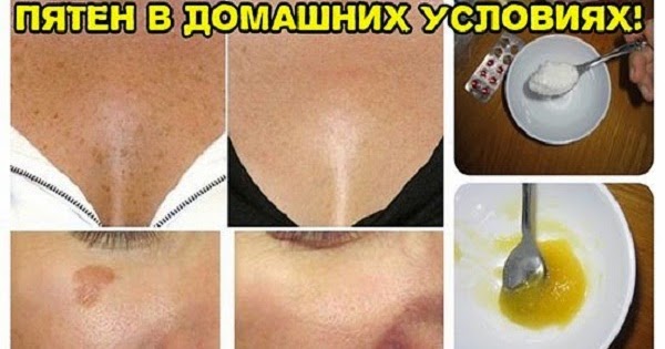 Отбелить кожу тела в домашних условиях быстро Отбелить кожу тела в домашних условиях быстро