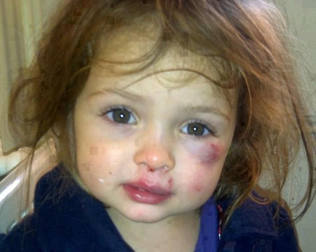 IMAGENES DE MALTRATO INFANTIL imagenes de maltrato infantil: