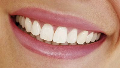 implante dental - sonrisa