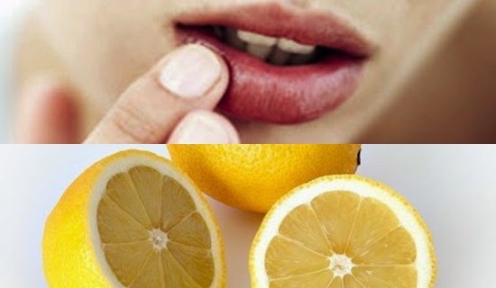 Bibir Anda Kering? Basahi Dengan Lemon Setiap Malam Bibir Anda Kering? Basahi Dengan Lemon Setiap Malam