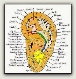 Auricular Therapy