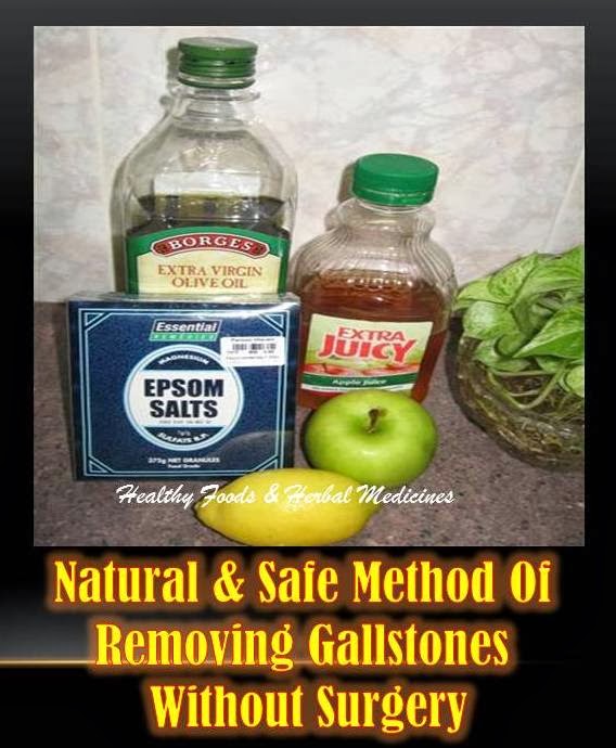 Foods To Remove Gallstones Naturally Foods To Remove Gallstones Naturally