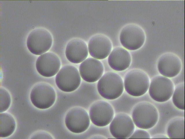 Live Blood Analysis Chart