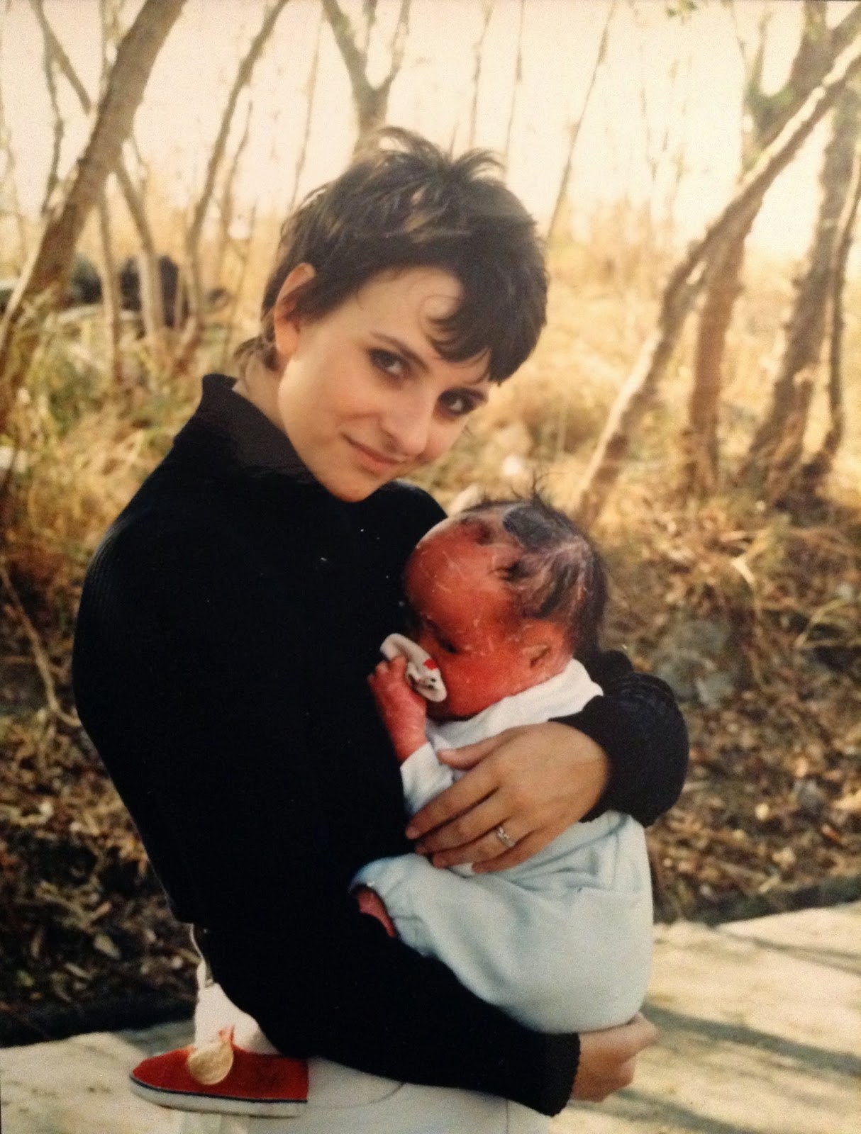 Mui as a baby with her mother. Mui has Harlequin Ichthyosis.