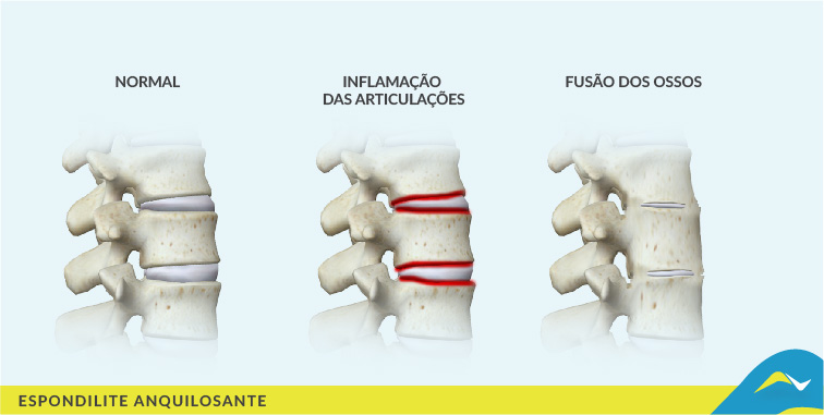 Tratamento de dores e doenças articulares