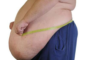 Penyebab Obesitas, Gejala Obesitas