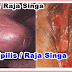 Obat Sipilis/Sifilis/Raja Singa, Obat Kencing Nanah, Obat Luka Di Kemaluan, Bintik Merah Di Kemaluan, Kemaluan Perih Dan Panas thumbnail