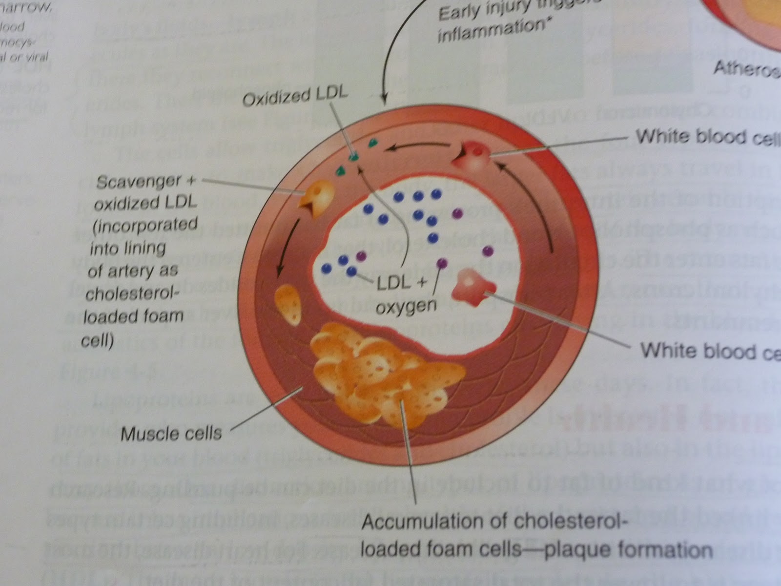 Epicurean DeLite What Really Causes Clogged Arteries?