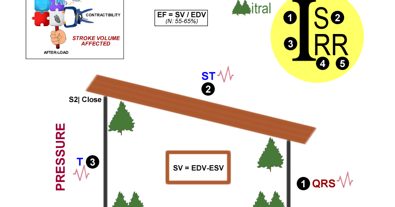 Medical MindMaps for USMLE Step 1: Cardiac Cycle