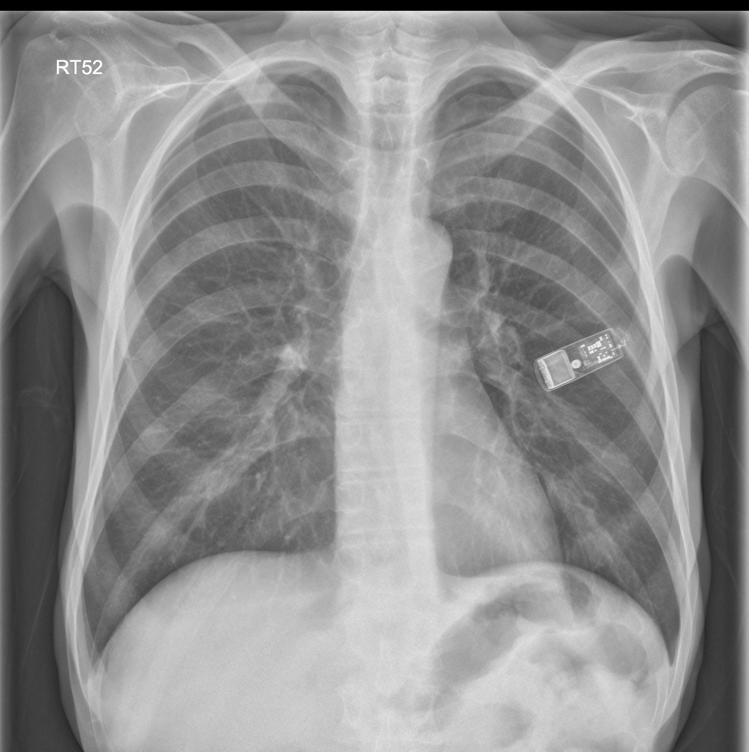 the xray doctor xrayoftheweek 43 that's not a USB stick...is it?