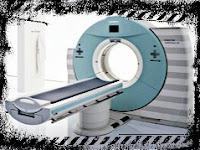 CT angiography