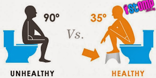 toilet duduk vs jongkok2