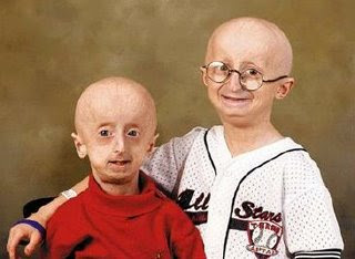 Kids with progeria