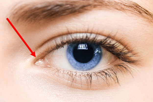 Shub's Thoughts What's in a Name, Lacrimal Caruncle