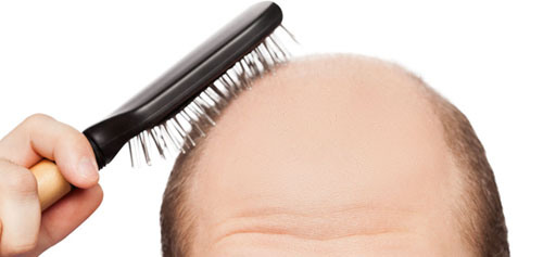 Info For You How To Naturally Regrow Hair In 15 Minutes A Day Pdf