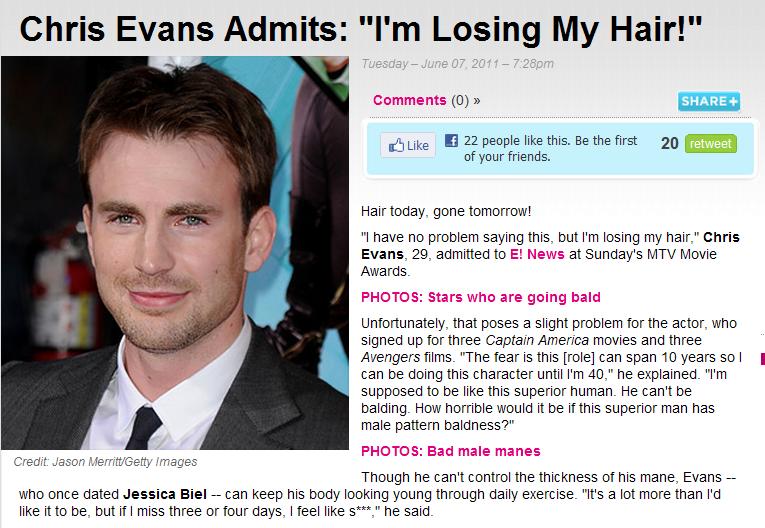 in the (212) Chris Evans' Bald Truth