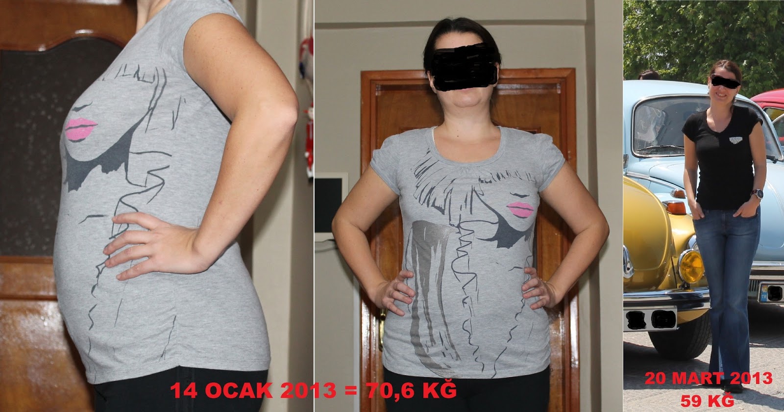 Kilo Verdikten Sonra Hamile Kaldım – 84 Kilodan 60 Kiloya Düşme Hikayem Kilo Verdikten Sonra Hamile Kaldım – 84 Kilodan 60 Kiloya Düşme Hikayem