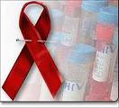 foto del signo del sida