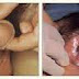 Vagina Keluar Cairan Putih Kayak Nanah, Tanda Gejala Apa? thumbnail