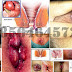 AmbeJOSS Bisa Buat Wasir Bumil dan Anak thumbnail