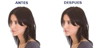 eliminar o quitar lunares,