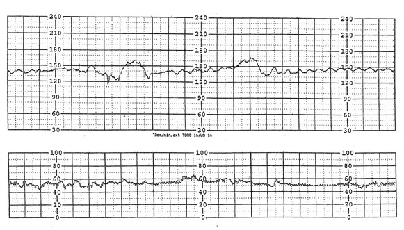 safer midwifery for michigan ask an ob fetal heart rate heart rate chart for boy or girl