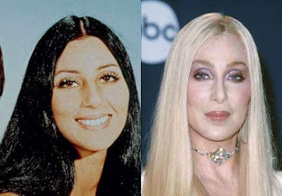 Cher Plastic Surgery Before and After Nose Job and Breast Implants