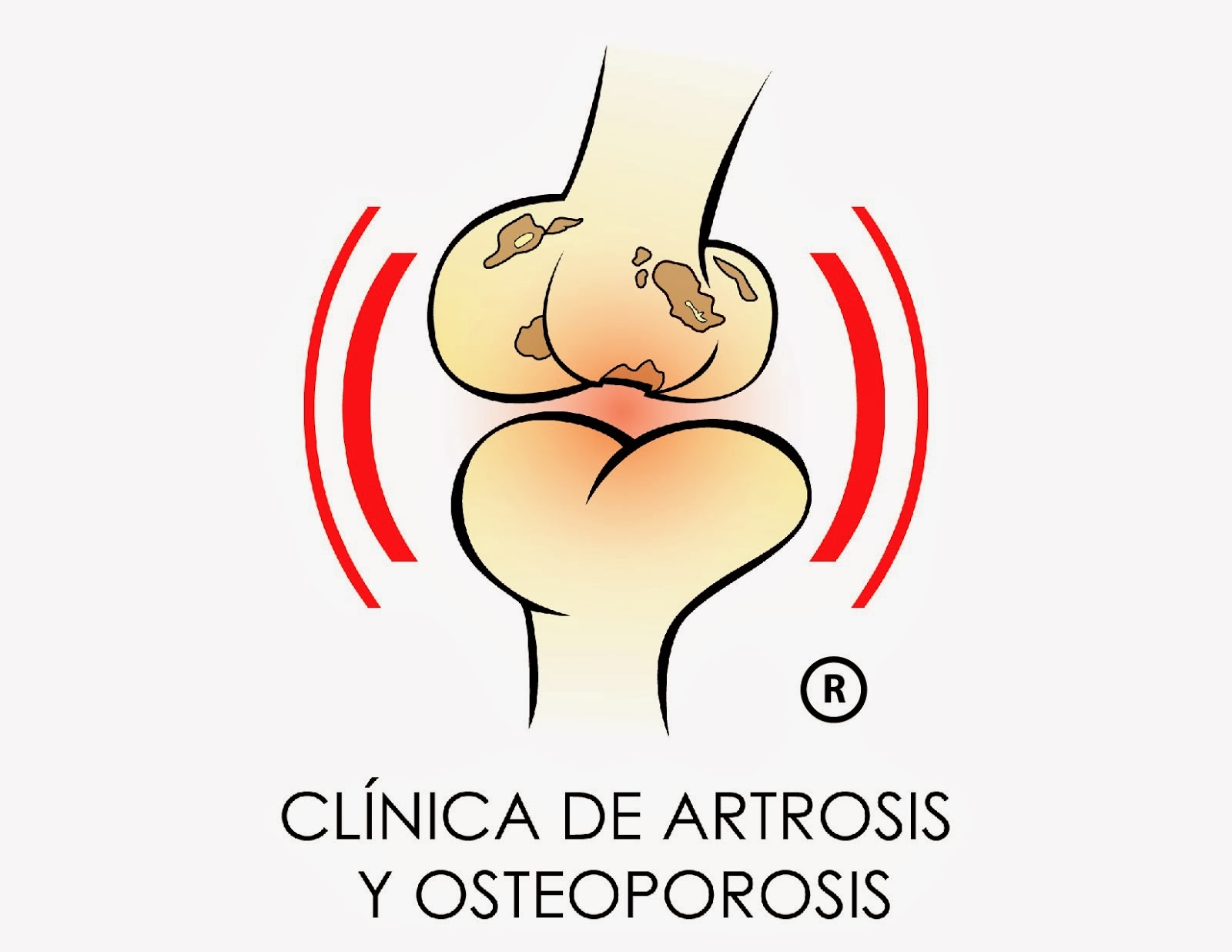 Clínica de Artrosis y Osteoporosis