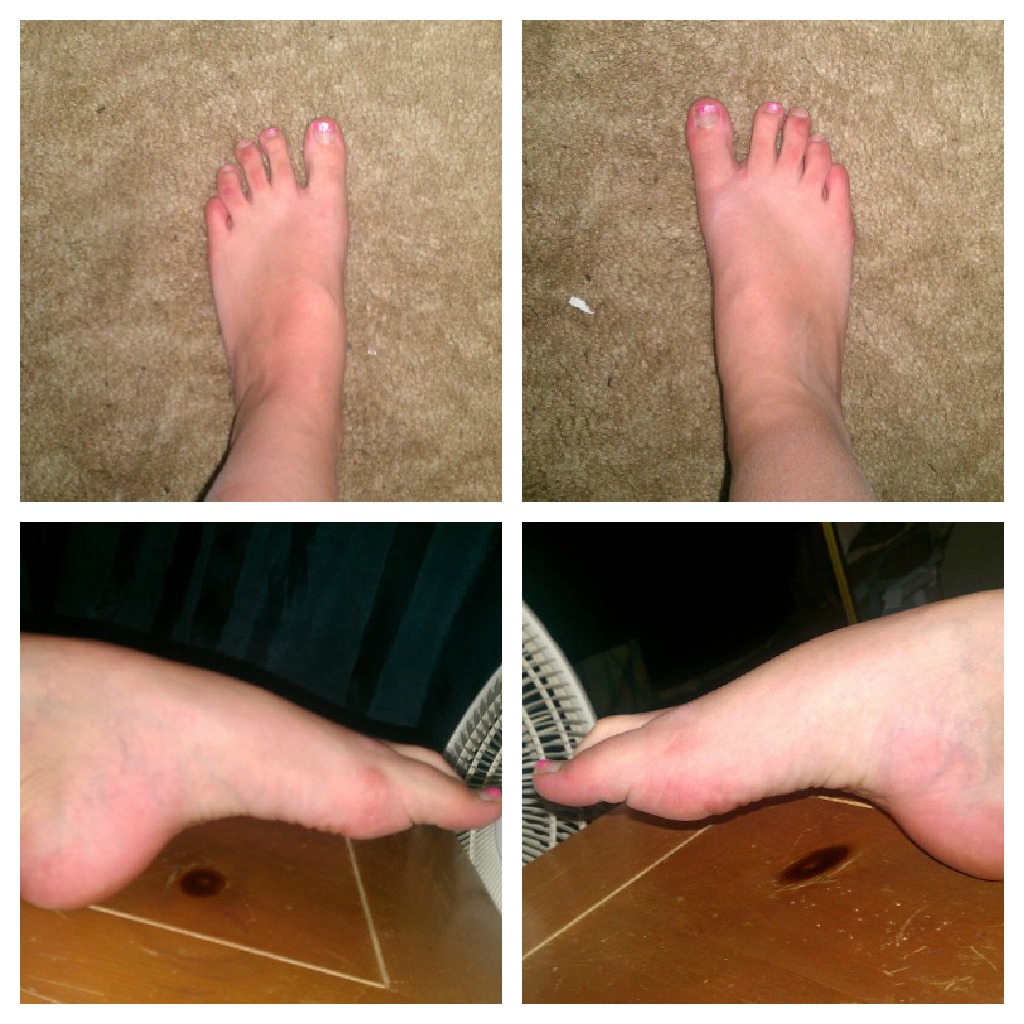 The Remedial Ballerina Learning Your Foot Type For The Best Pointe Fit