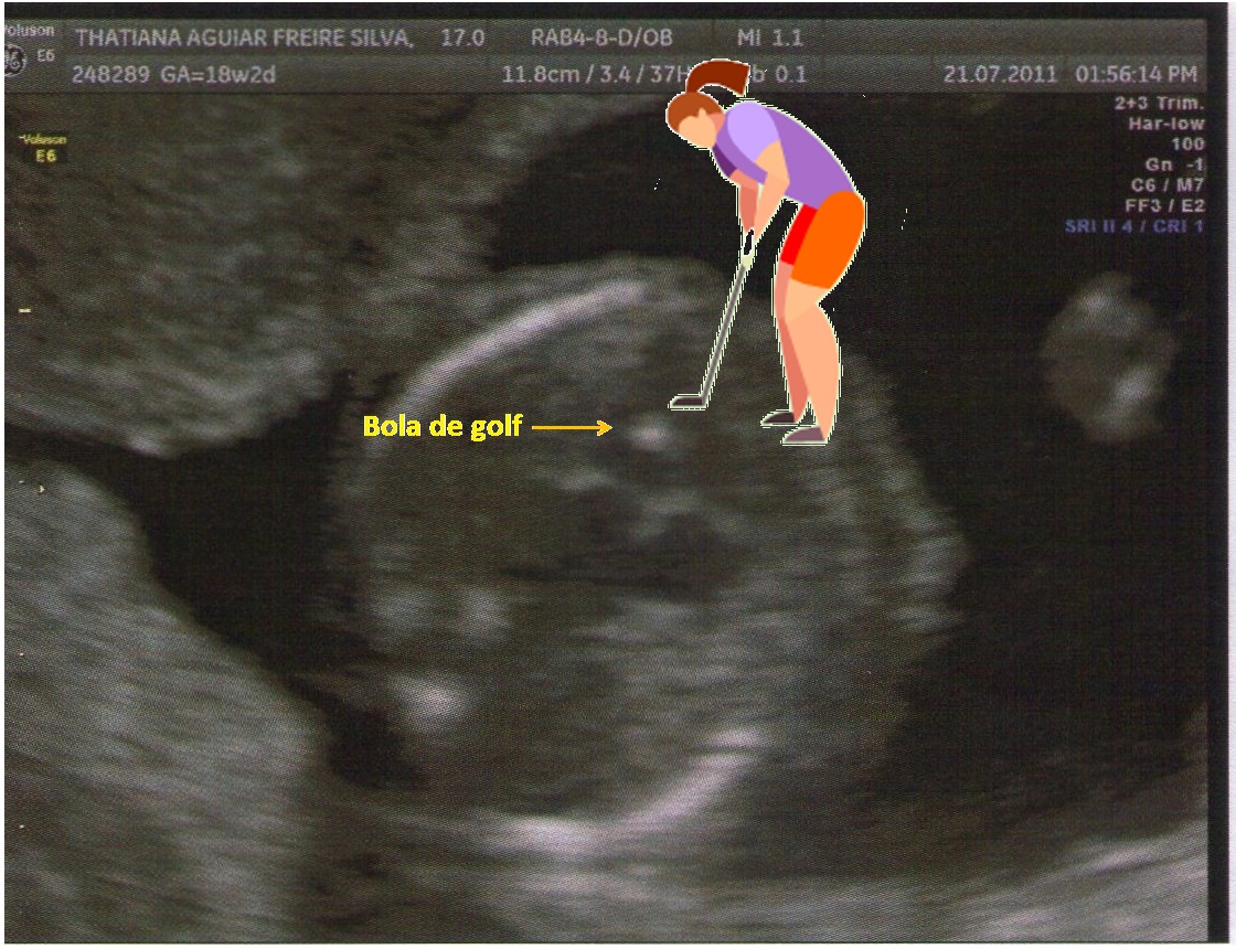 Povoando o mundo de gente do bem! Bola de golf golf ball