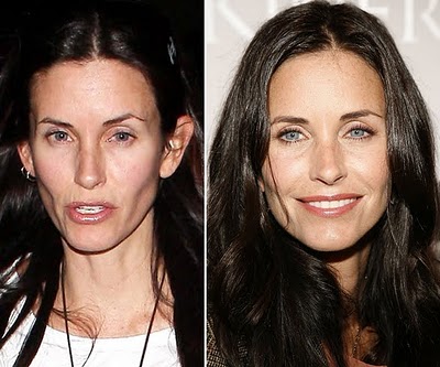 There are rumors that actress Courtney Cox had plastic surgery