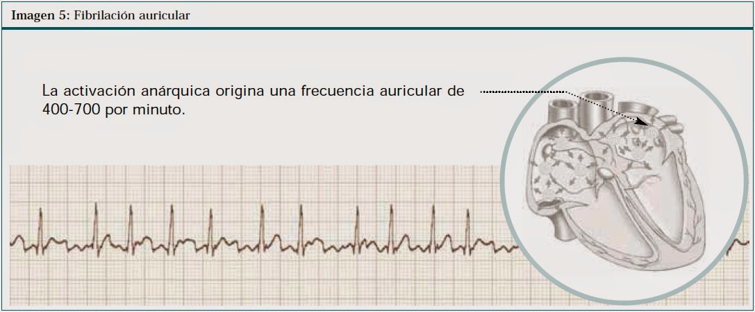 Clula nodal sinusal y clula miocrdica t Clula nodal sinusal y clula miocrdica t