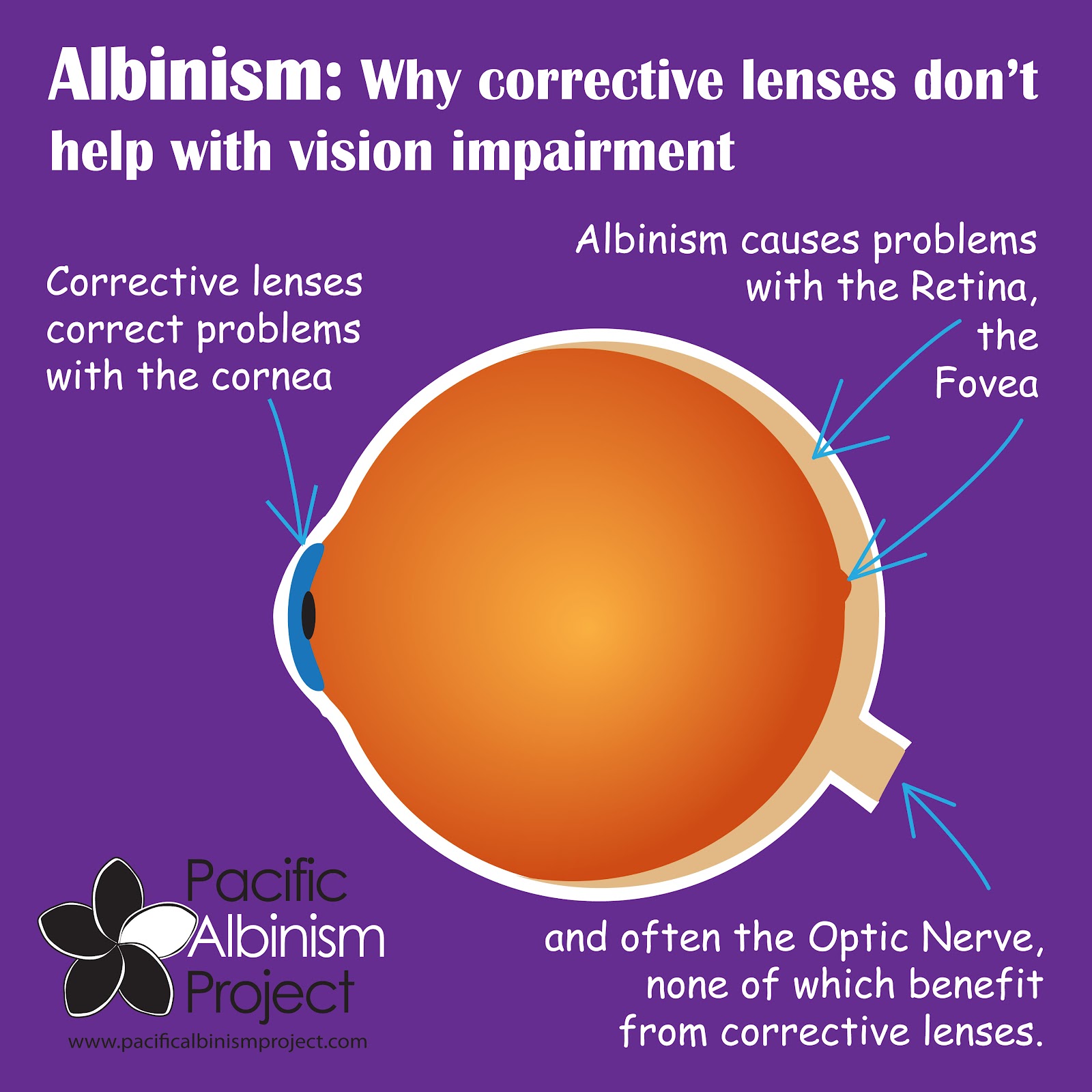 albinism research paper The national center for biotechnology information advances science and health by providing access to explore ncbi research and collaborative projects. albinism research paper The national center for biotechnology information advances science and health by providing access to explore ncbi research and collaborative projects.