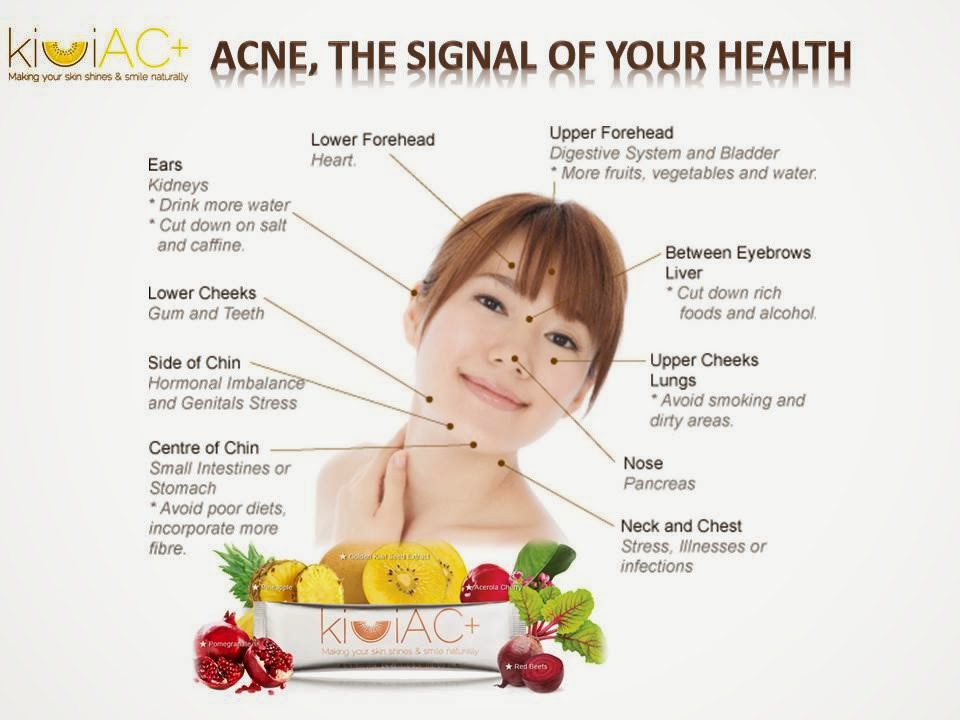 Диета При Прыщах На Лице На Неделю