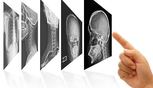 Eba Ag Eba Ag De Jetzt Auch Im Radiologieforum 2015