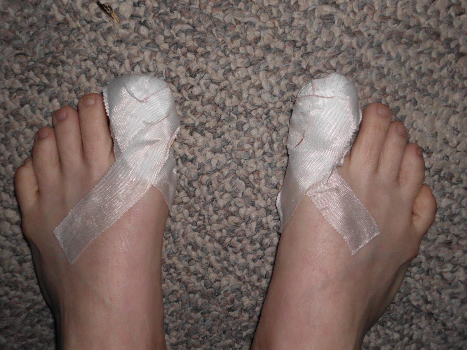 Lewis and Clark Hurting toes