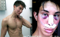 operacion justin barbie ken