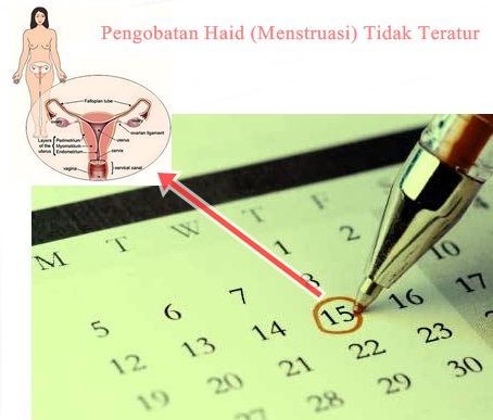 Pengobatan Haid (Menstruasi) Tidak Teratur Pengobatan Haid (Menstruasi) Tidak Teratur