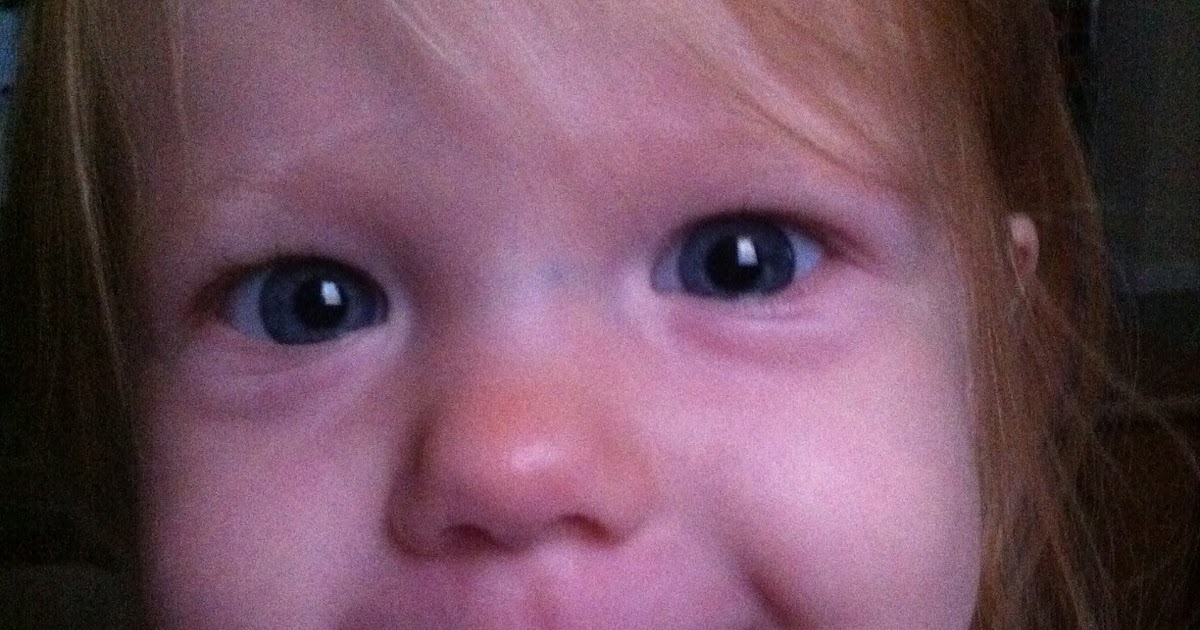 The Wehrman's Allergic to Almonds