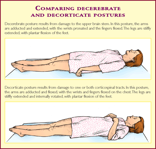 Intensive care HG1: El custodio comatoso -respuestas-