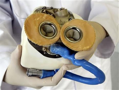 http://2.bp.blogspot.com/_-QzHaHjalQY/SRD_5TB2cCI/AAAAAAAABSc/Wy0qkhehie0/s400/artificial_heart_1.jpg