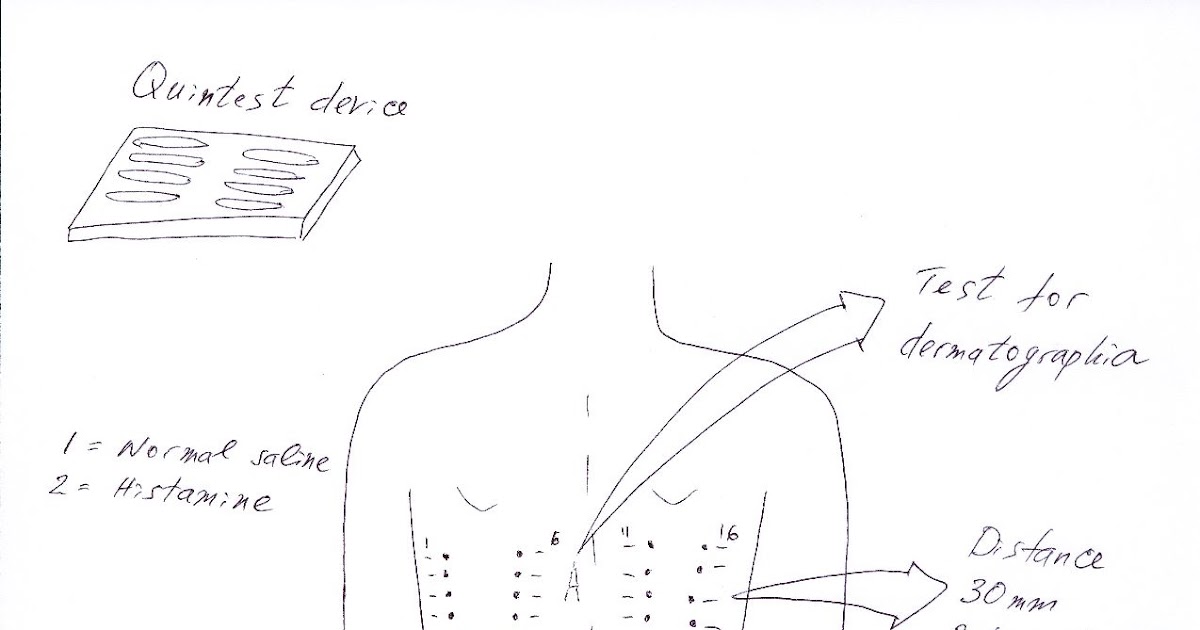 AllergyCases Procedure Guide Subcutaneous Immunotherapy