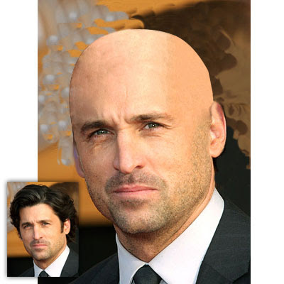 Lil Wayne Bald Pic, lil wayne bald head. Lil Wayne Bald Pic,
